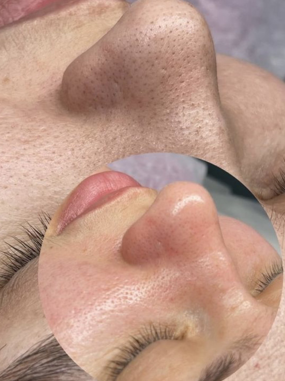 Before and after skin results